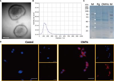 Frontiers Outer Membrane Vesicles Of Porphyromonas Gingivalis Trigger